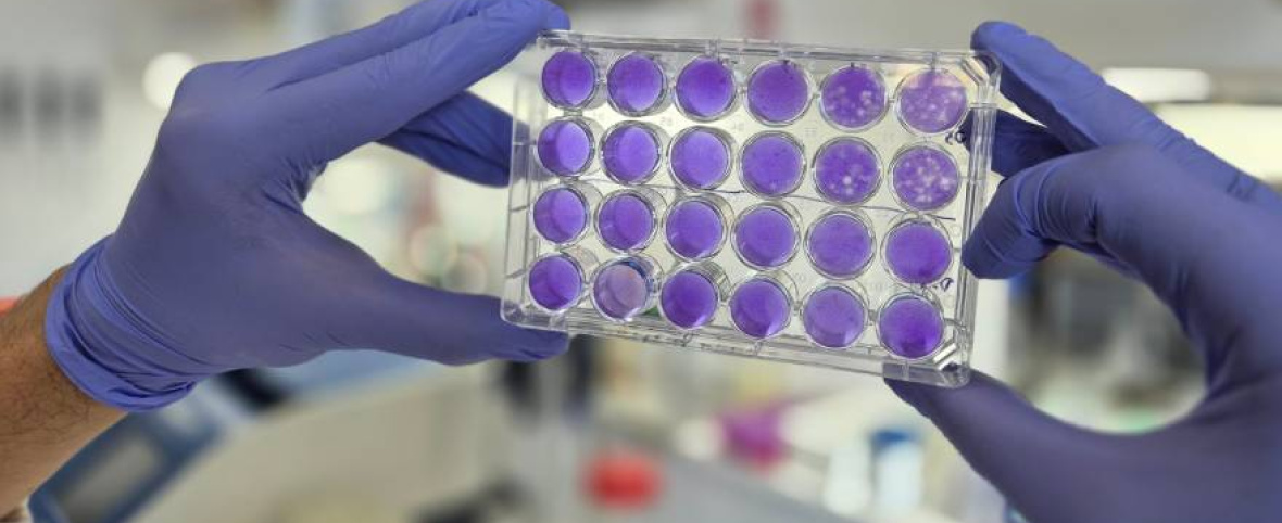 Hallan un mecanismo común de replicación para los virus del dengue, Zika y fiebre amarilla