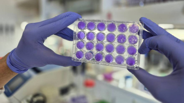 Hallan un mecanismo común de replicación para los virus del dengue, Zika y fiebre amarilla