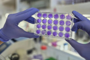 Hallan un mecanismo común de replicación para los virus del dengue, Zika y fiebre amarilla